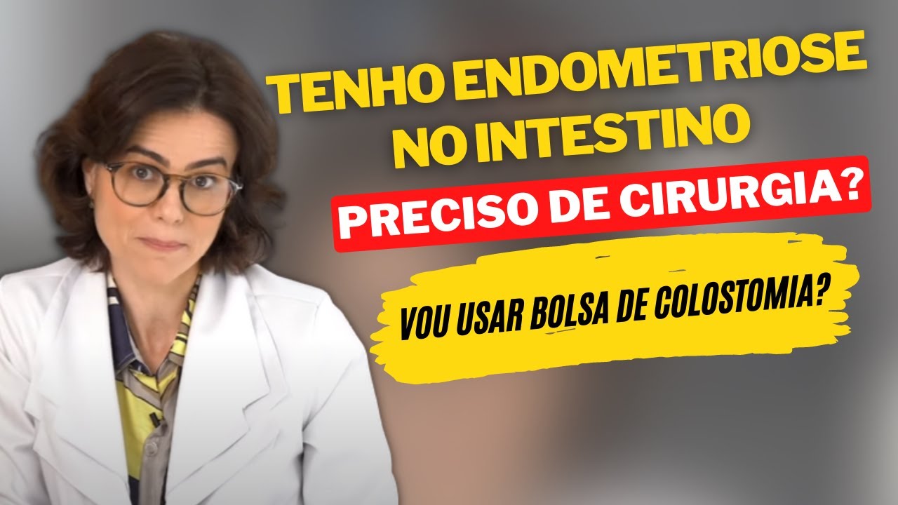 Tenho endometriose no intestino. Preciso de cirurgia? Vou usar bolsa de colostomia?