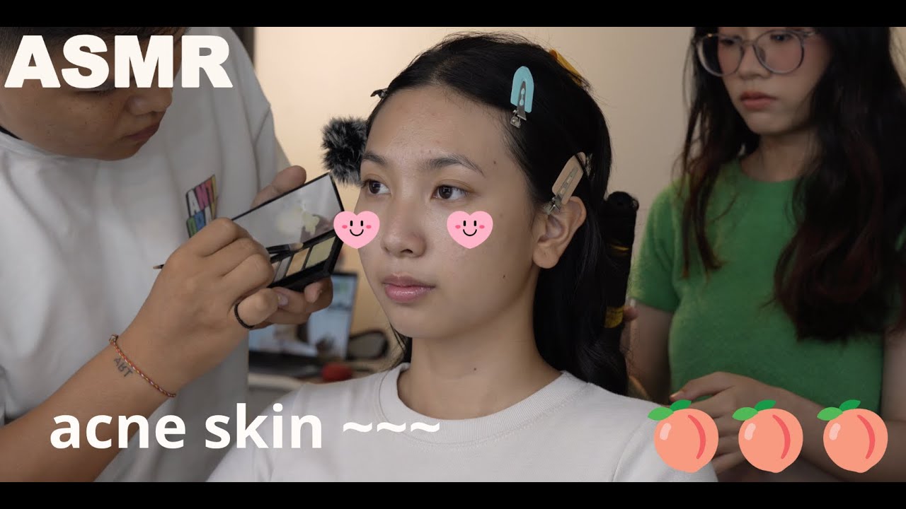 (sub)🍑🍇 𝑨𝑺𝑴𝑹 𝒘𝒊𝒕𝒉 𝑯𝒊𝒆𝒖 | Xử lý da mụn liệu có phẳng lỳ như bạn nghĩ ?! 𝐏𝐄𝐌𝐄𝐋𝐎 𝐏𝐄𝐀𝐂𝐇𝐘 𝐁𝐋𝐔𝐑𝐑𝐈𝐍𝐆 𝐌𝐀𝐊𝐄𝐔𝐏