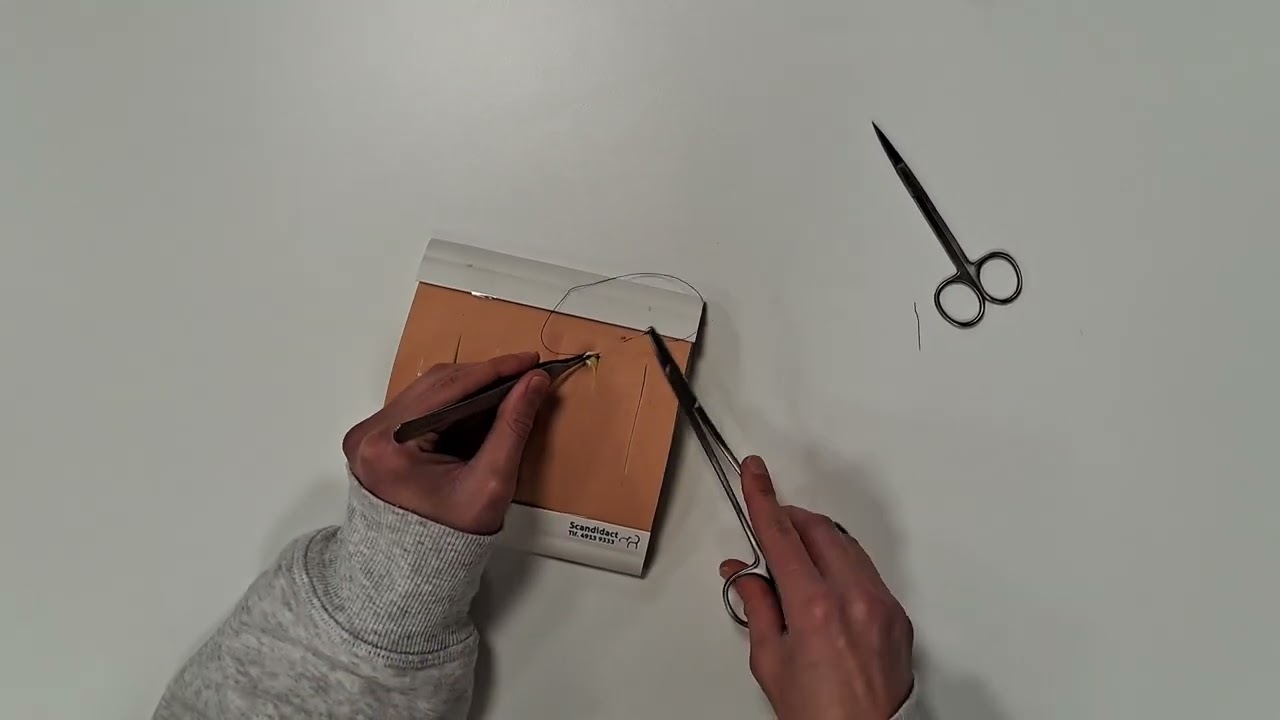 Intracutaneous Suture