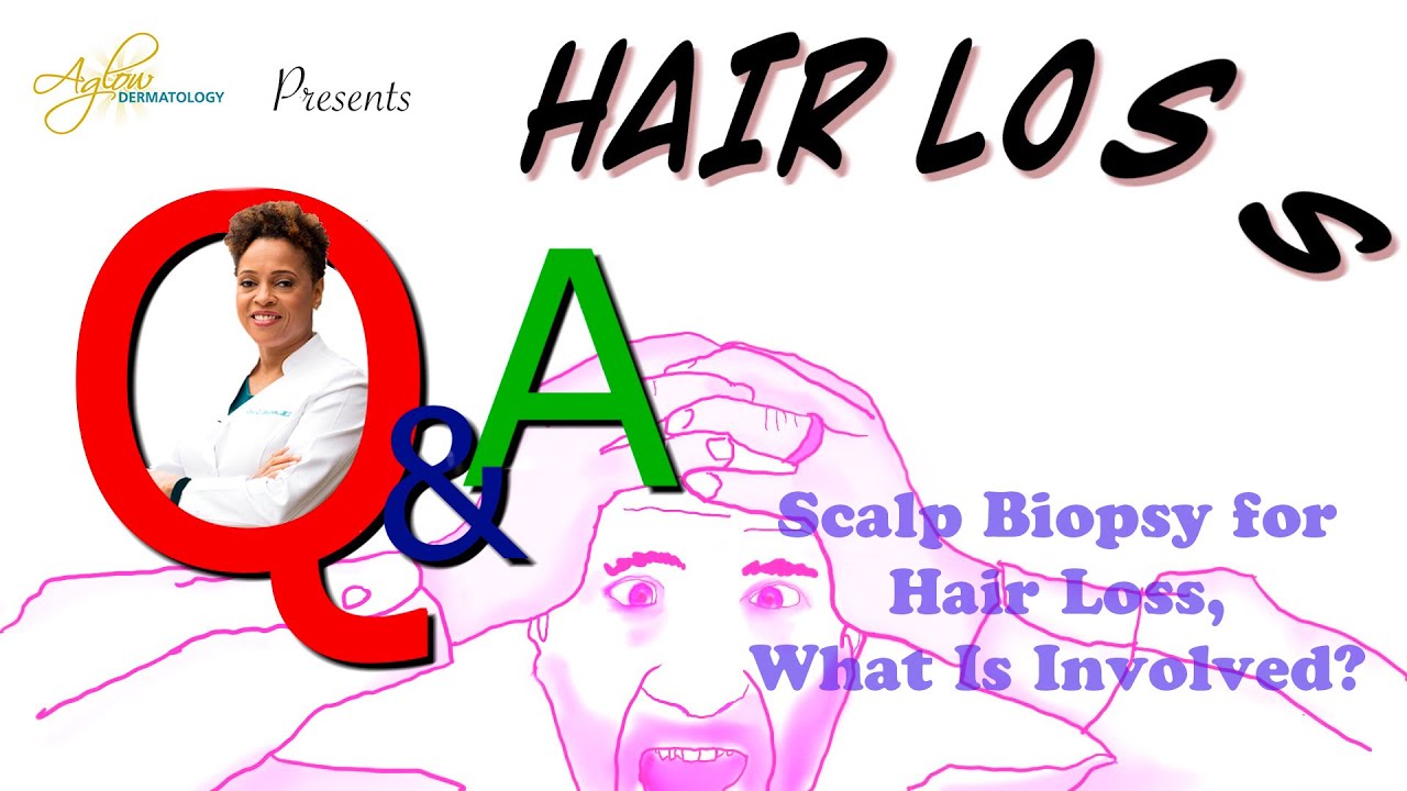 Scalp Biopsy for Hair Loss, what is Involved?