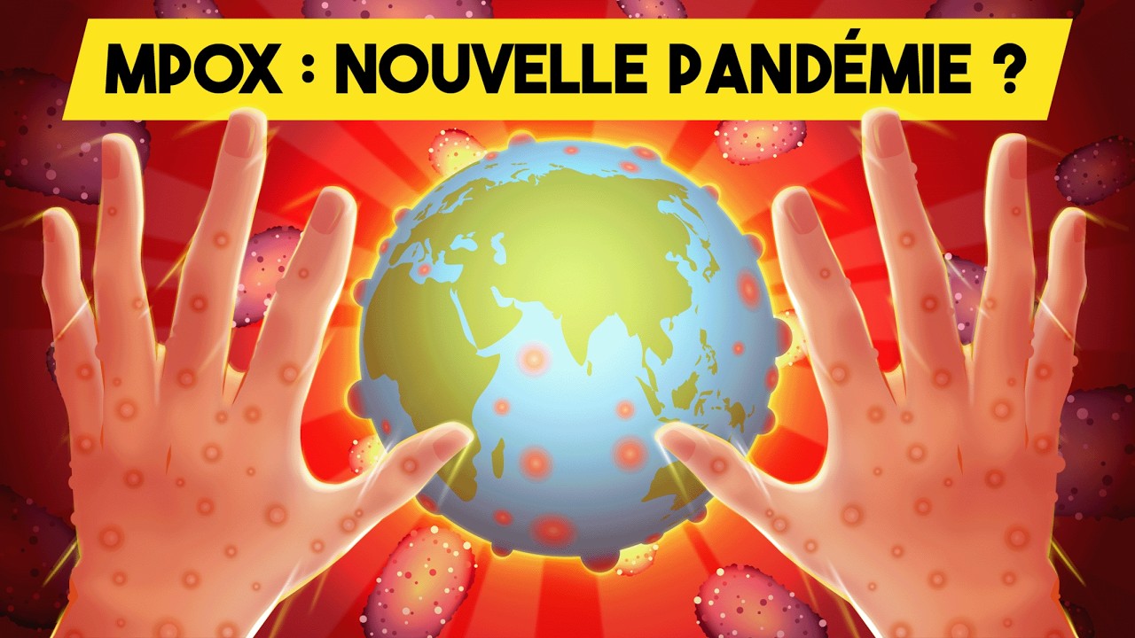 MPOX : La PROCHAINE pandémie ? | Variole du singe | Monkeypox