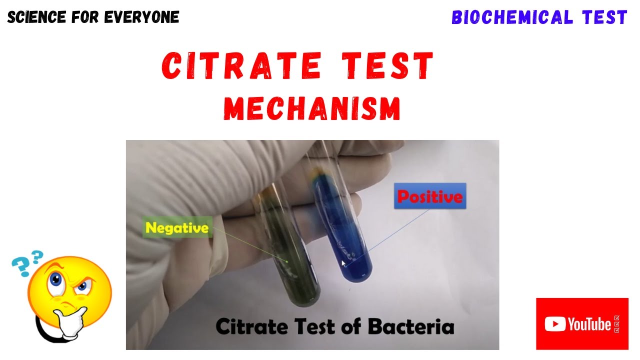 CITRATE TEST | Principle | Procedure | Understanding Results | Chemical Reactions