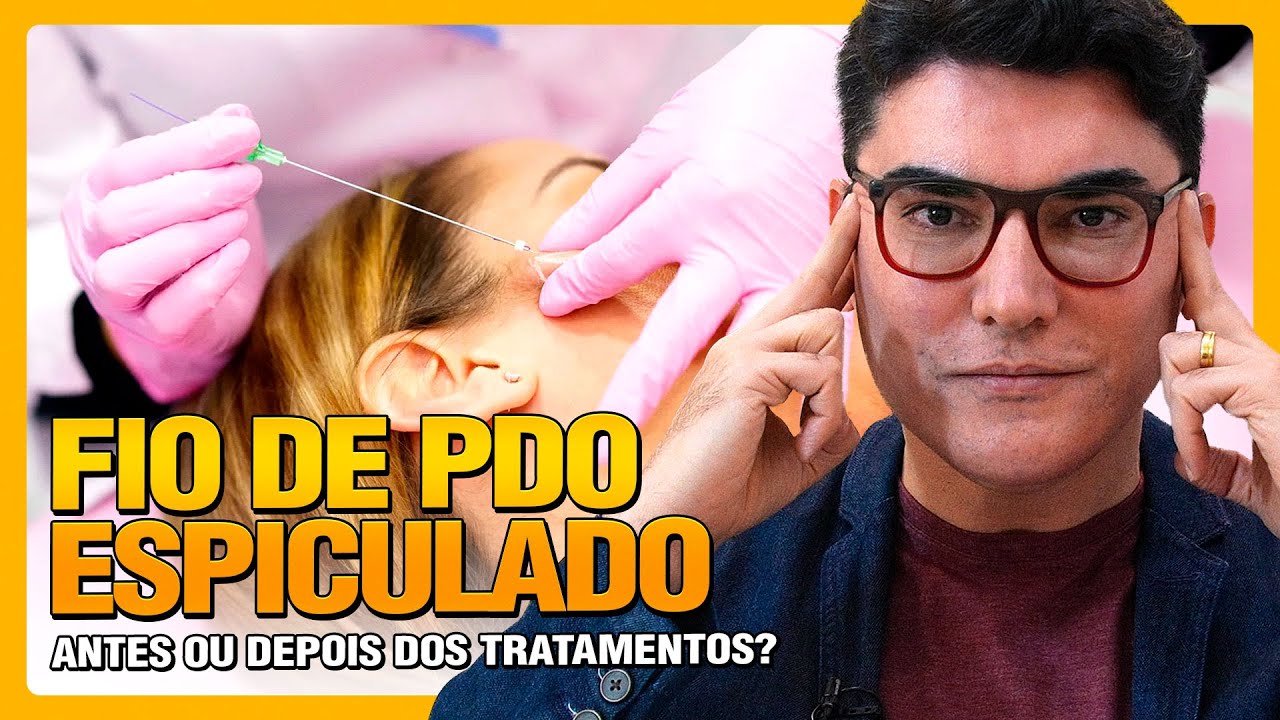 FIO DE PDO ESPICULADO Antes ou Depois dos Tratamentos?