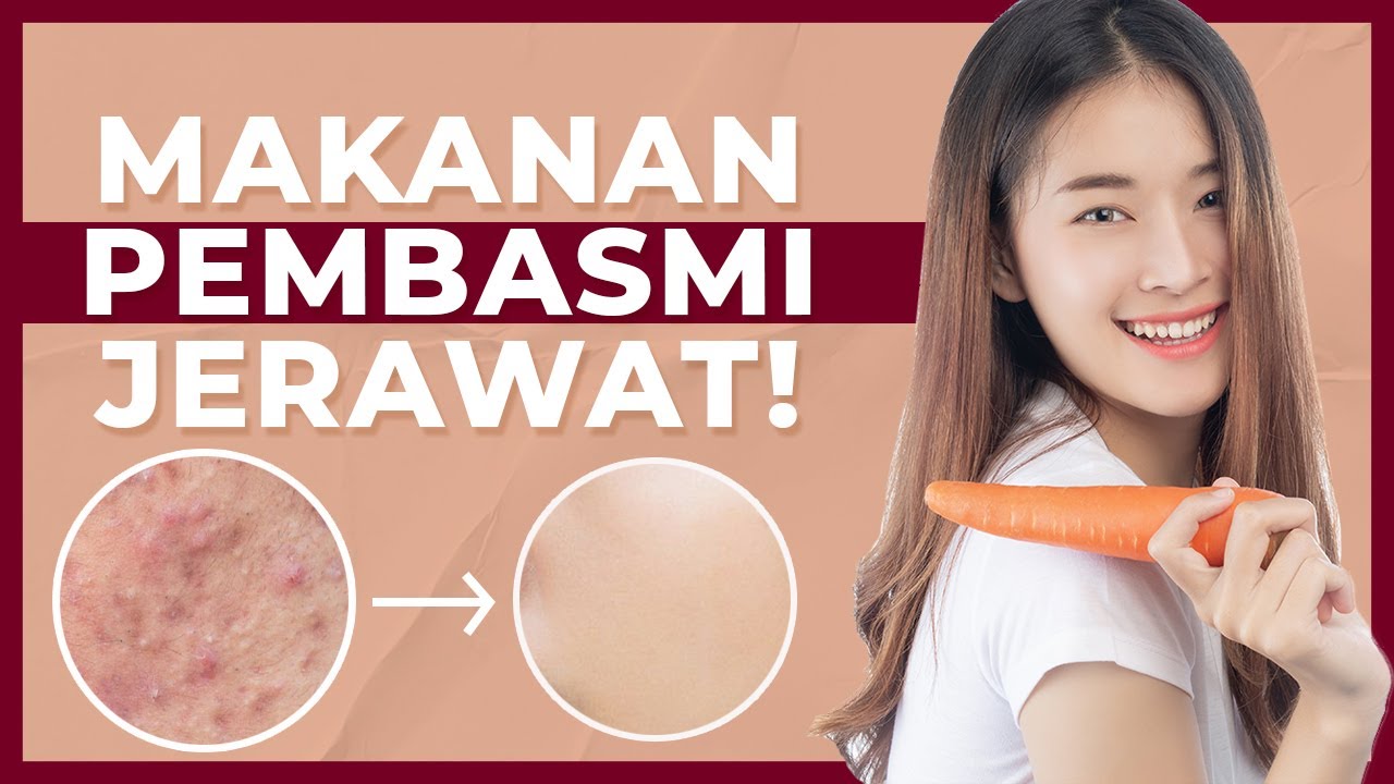 Wajib Dikonsumsi! Ini 4 Makanan Murah Untuk Menghilangkan Jerawat!