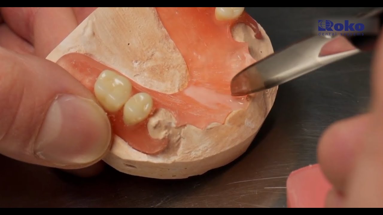Thermoplastic dentures - Repair and service