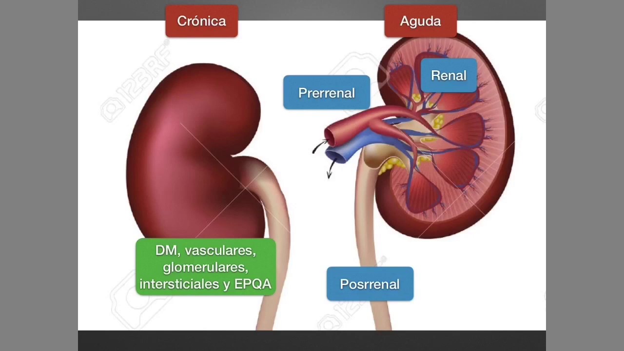 Insuficiencia renal crónica