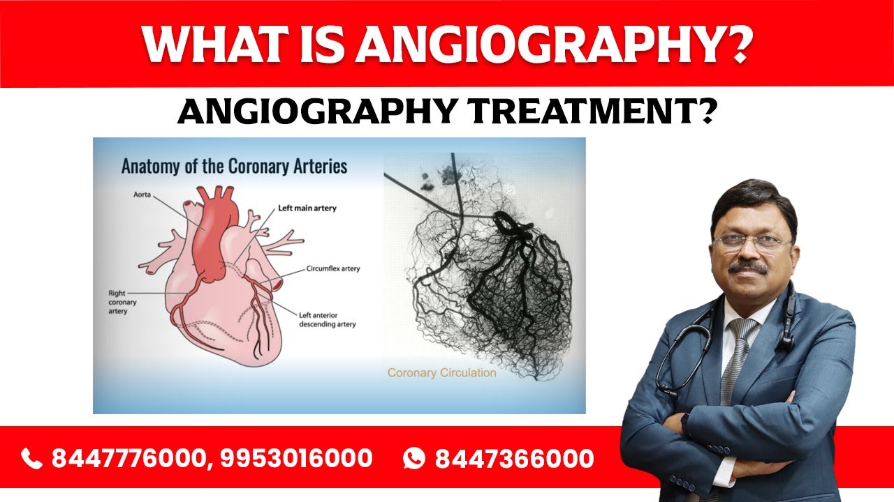 What is Angiography? Angiography Treatment by Dr. Bimal Chhajer
