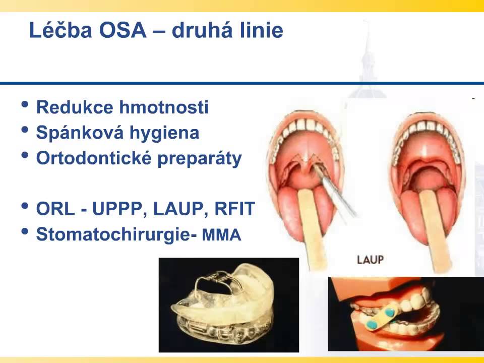 Vliv syndromu spánkové apnoe na kardiovaskulární a metabolické choroby