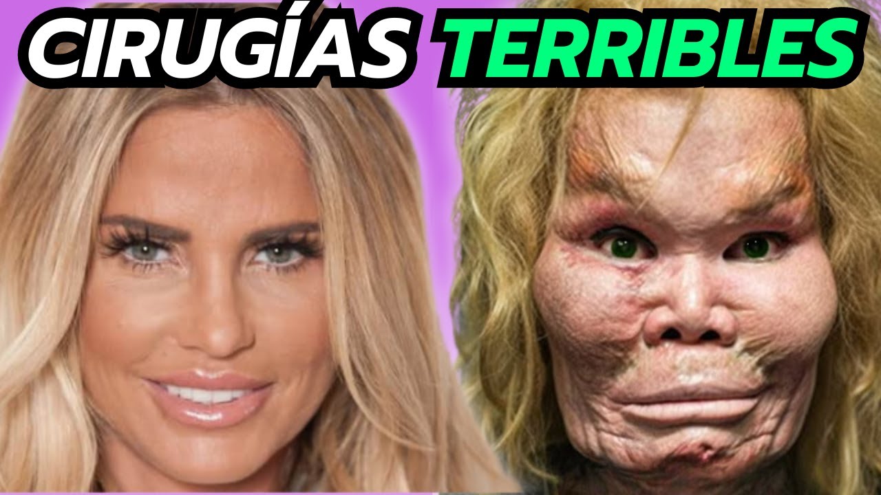 20 Cirug&iacute;as Que Salieron Terriblemente Mal De Celebridades y Famosos