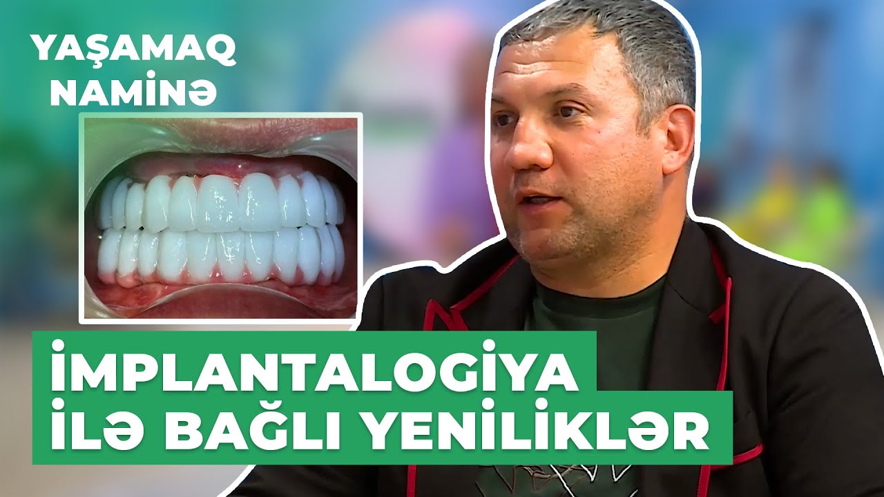 Yaşamaq Naminə | Doktor Sənan Xankişiyevdən implantalogiya ilə bağlı son yeniliklər