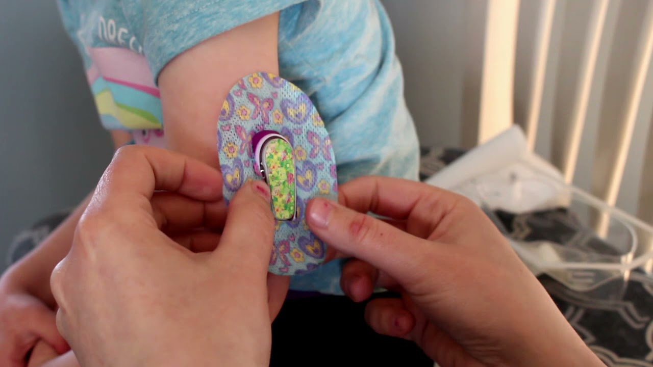Dexcom G6 Shield Application