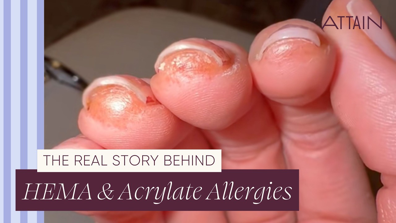 How to Do Gel Nails at Home | HEMA, Monomers & The Real Story Behind Nail Allergies