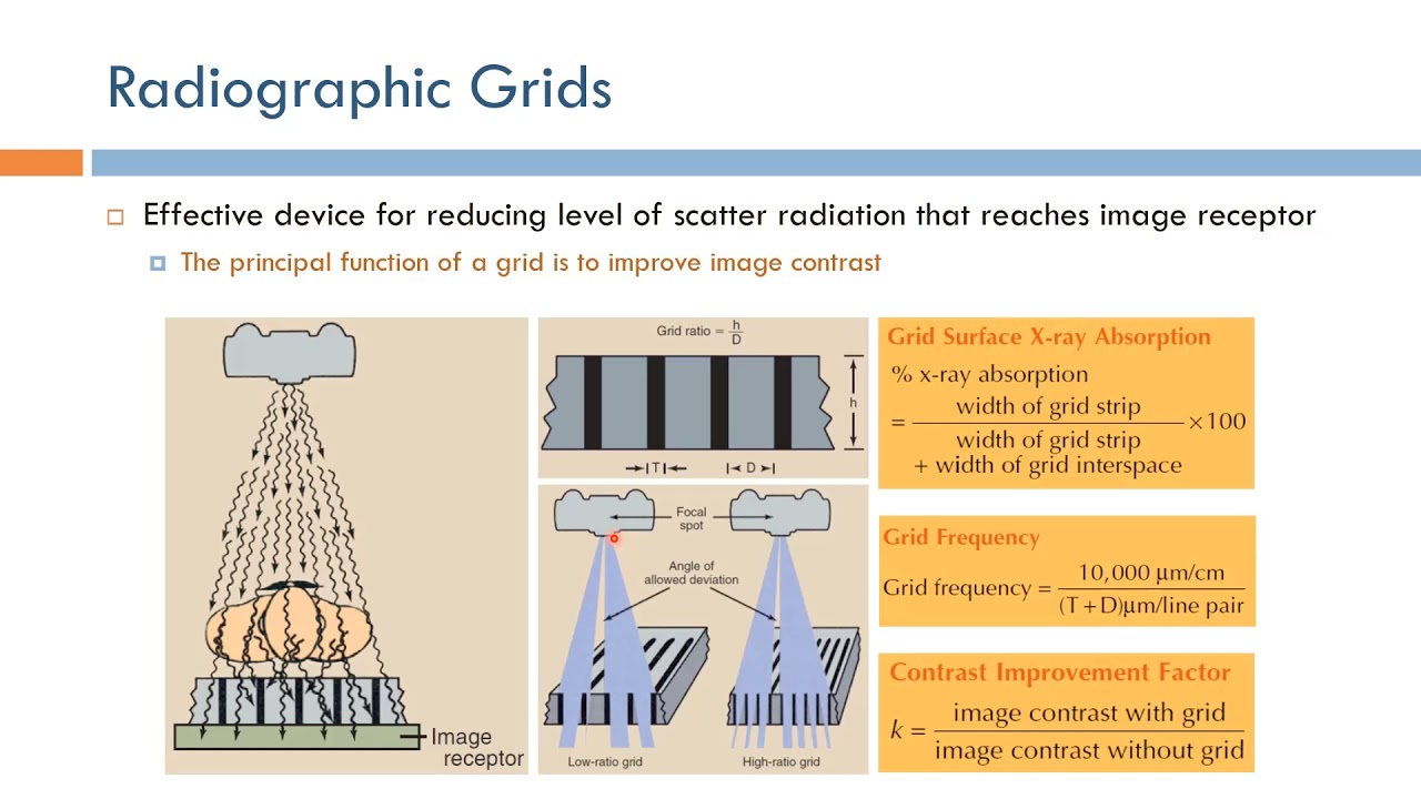Short Topics in X-Ray Imaging: Radiographic Grid Basics (Arabic Narration)