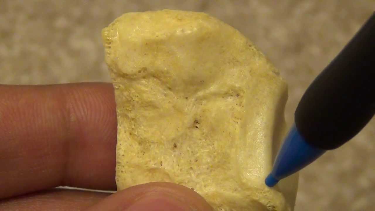 Anatomy and Osteology of the First / Medial Cuneiform