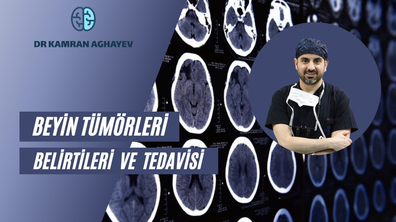 Beyin Tümörlerinin türleri ve belirtileri nelerdir, tedavisi nasıl yapılır?