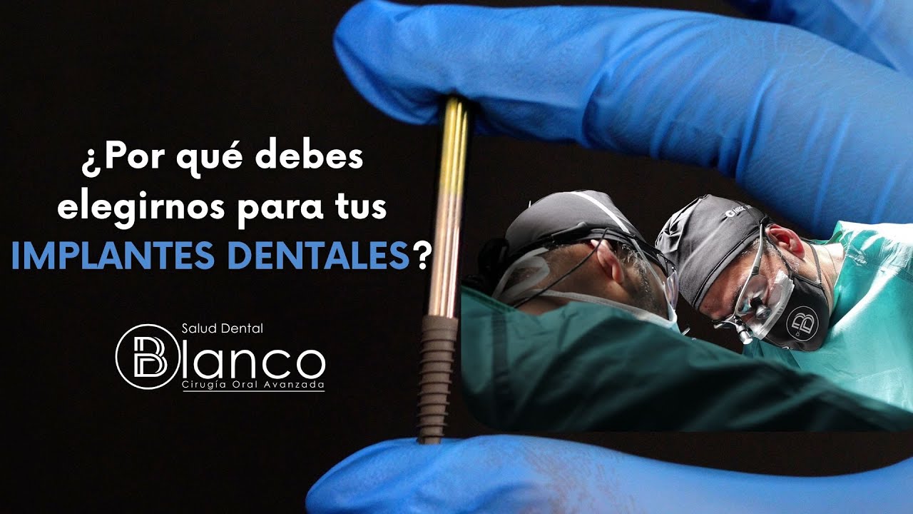 &iquest;Por qu&eacute; elegir Salud Dental Blanco para tus implantes dentales?