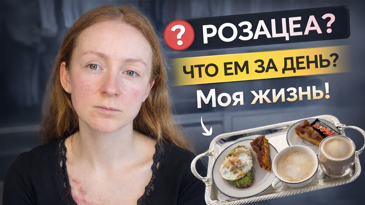 Как я живу с розацеа | Что я ем за день? ДЕНЬ 30
