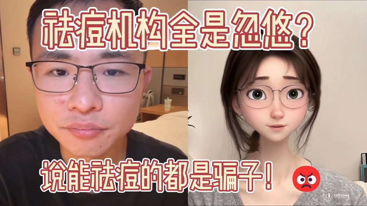 三甲医院都治不好痘痘？说能祛痘的都是骗子！😡长痘就该认命？治好能成世界首富？黄仁勋都不行！💸专业祛痘机构全是忽悠？敢说能治就是诈骗！⚠️