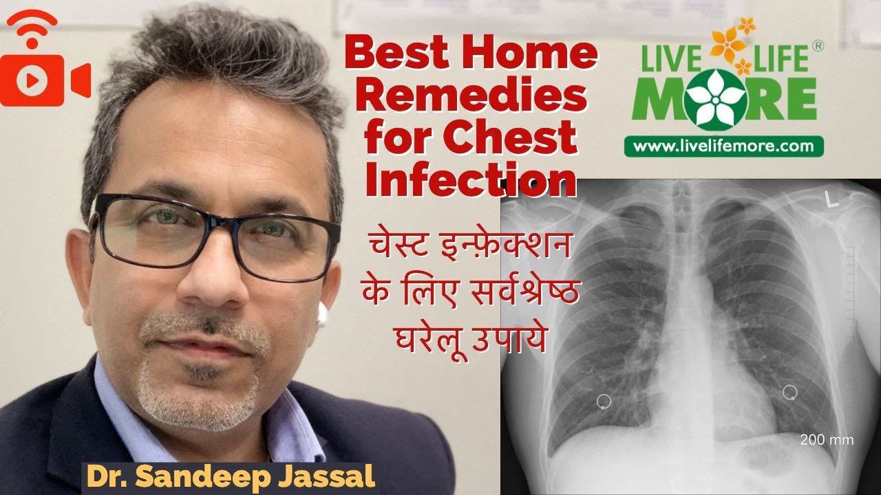 Best Home Remedies for Chest Infection - Chest Infection Symptoms in Hindi - Dr. Sandeep Jassal