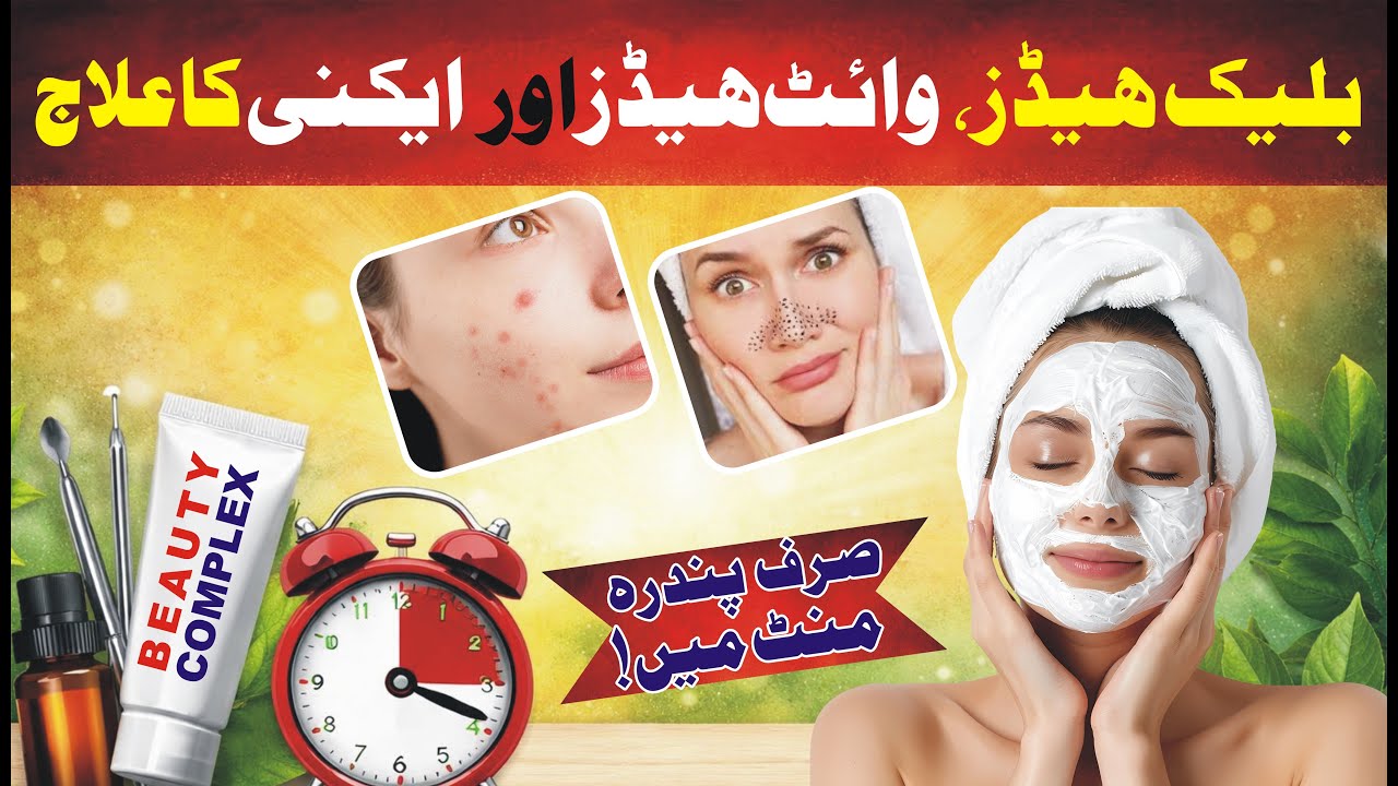 بلیک ہیڈز ، وائٹ ہیڈز اور ایکنی کا آسان علاج || Easy treatment of blackheads, white heads and acne