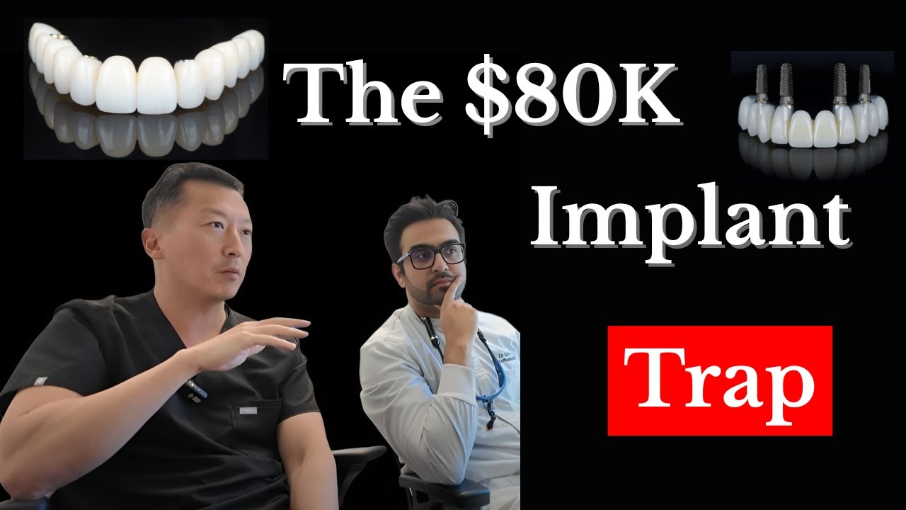 FP1 vs FP3 Dental Implants: When It Works and When It Fails