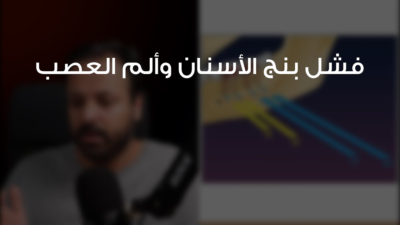 فشل بنج الأسنان وألم العصب
