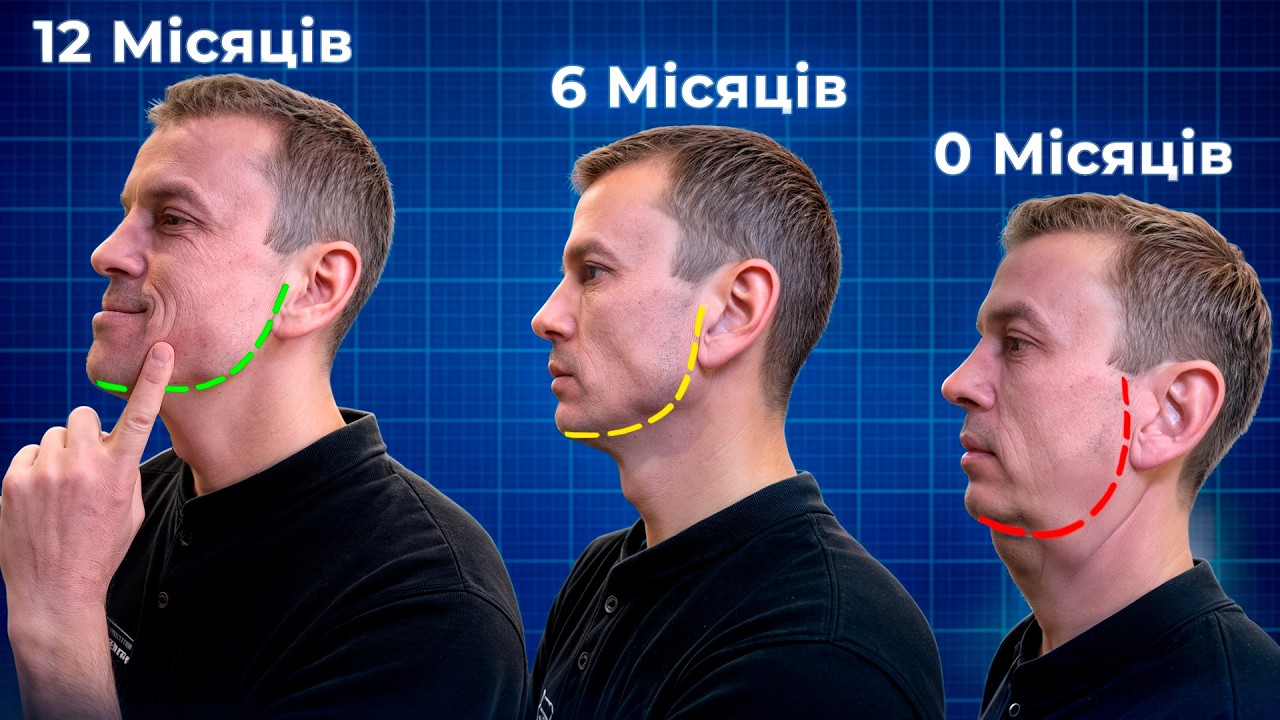 Що таке Мьюінг? Безпечно для життя?