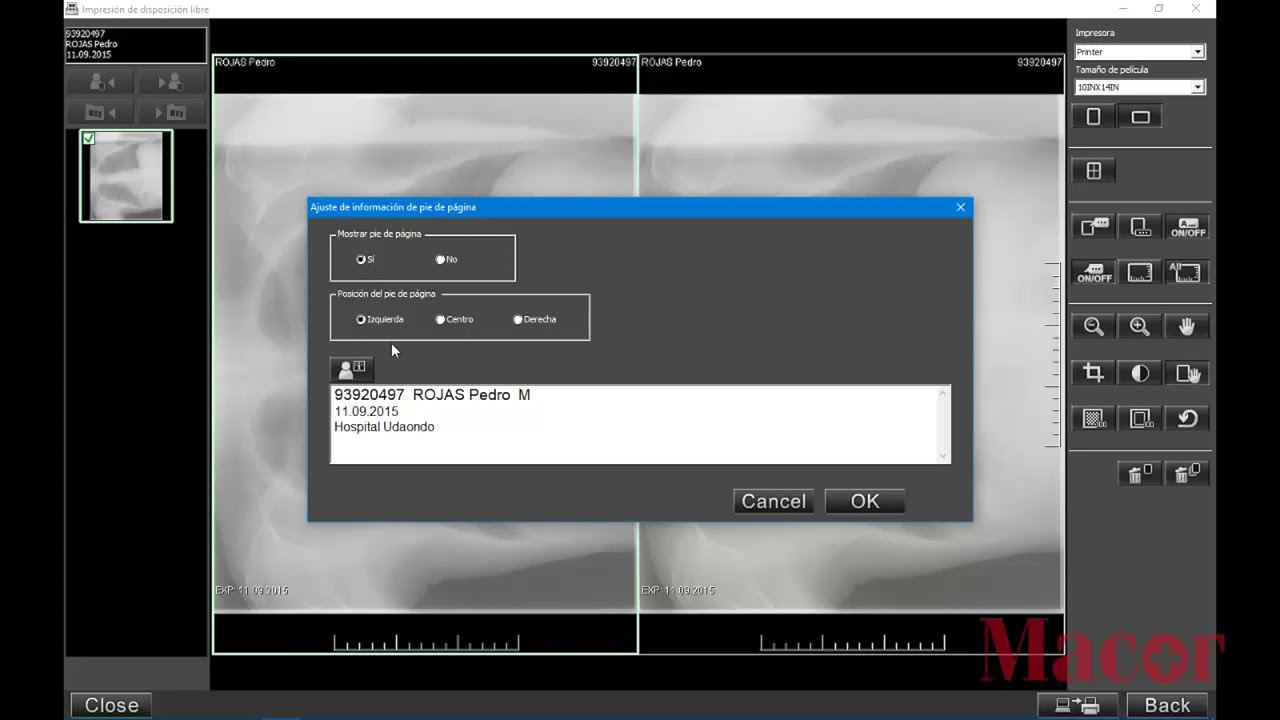 Tutorial - Prima Console - Impresión Formato libre