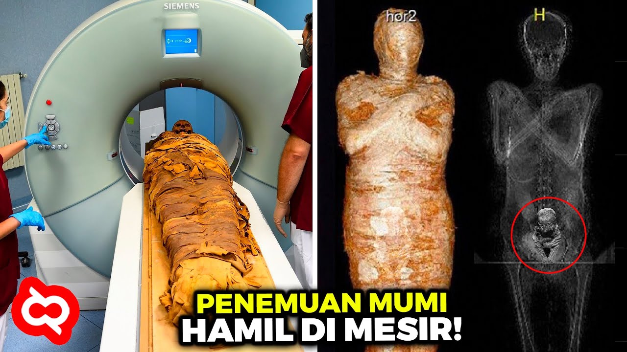 Arkeolog Syok Temukan Sosok Mumi Mesir Kuno yang Lagi Hamil, Setelah Diselidiki Lebih Jauh Ternyata