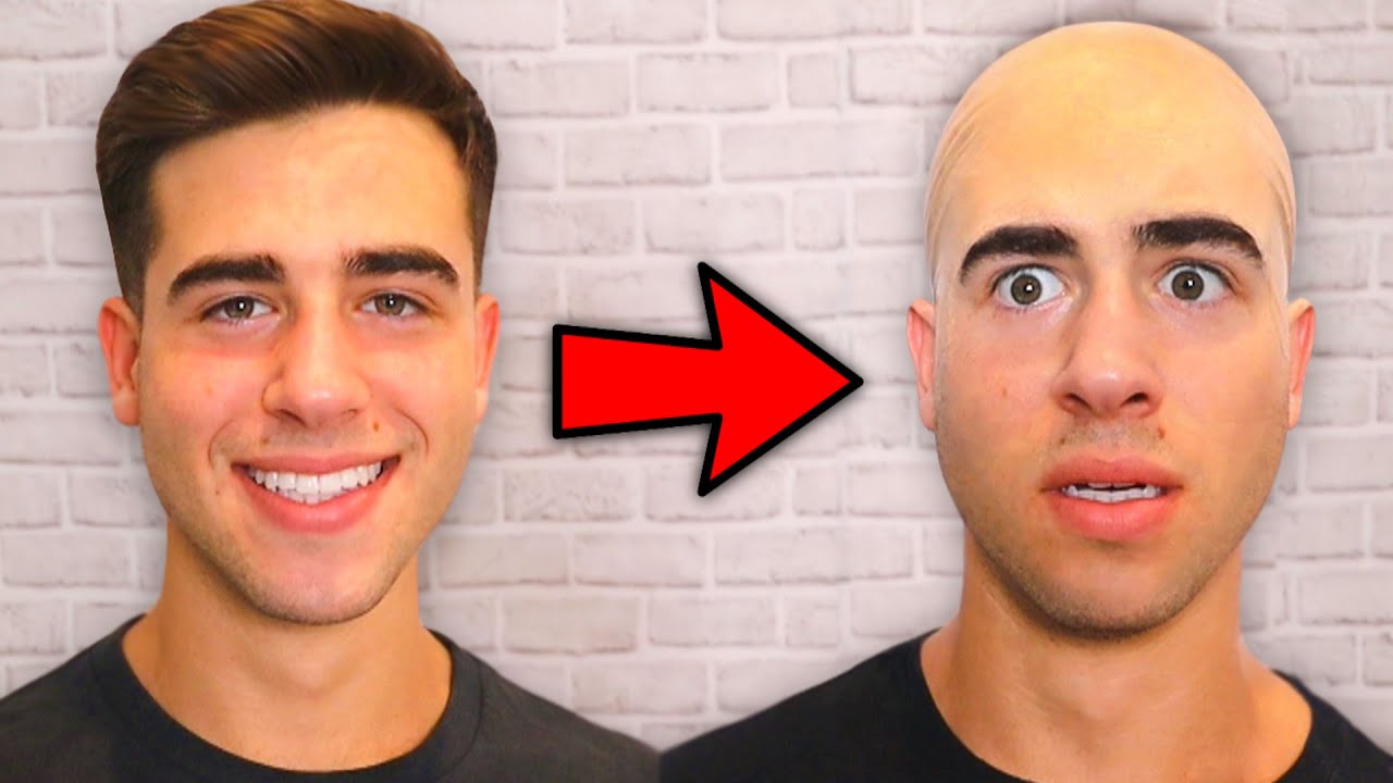 I Went Bald..