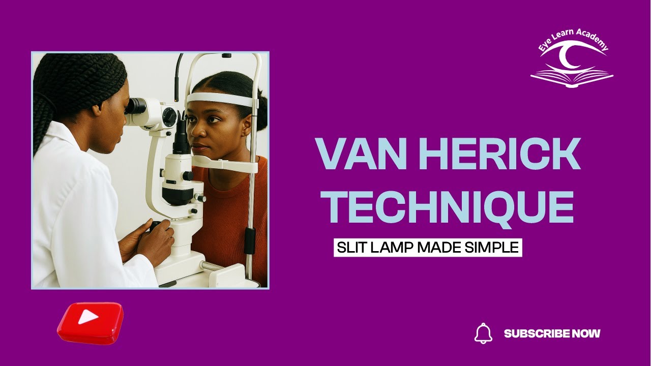 How to Perform the Van Herick Test | Optometry Slit Lamp Tutorial.