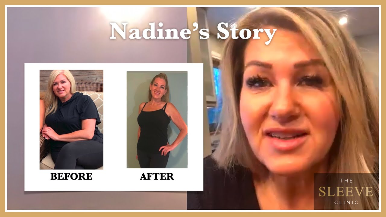 Nadine’s Journey To Losing 56 lbs With The Sleeve Clinic