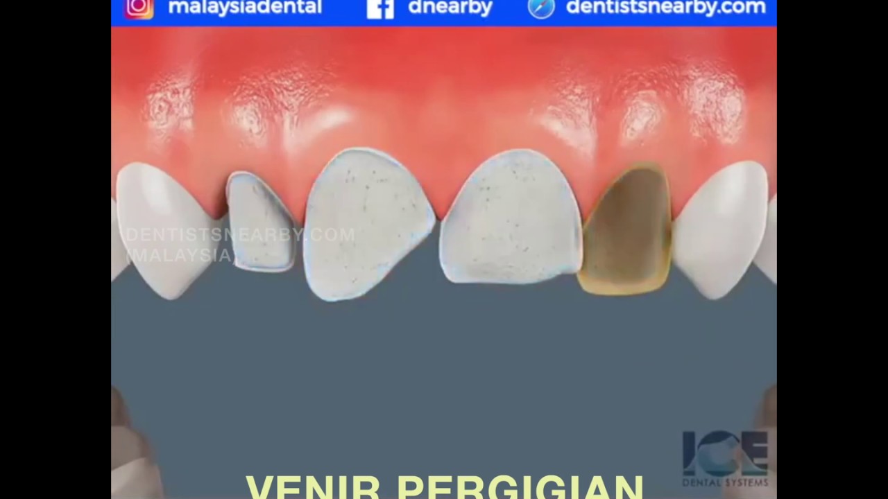 Pelbagai Rawatan Pergigian Umum