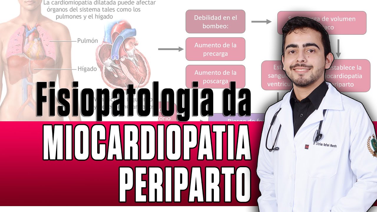 Fisiopatologia da Miocardiopatia Periparto │ PORTH (Capítulo 32)