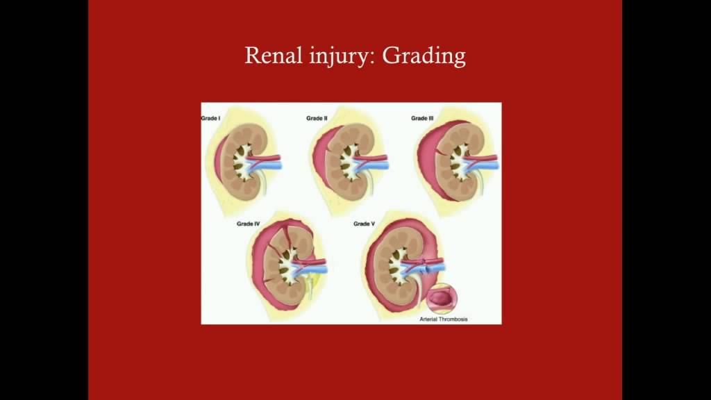 Proximal Genitourinary Trauma - CRASH! Medical Review Series