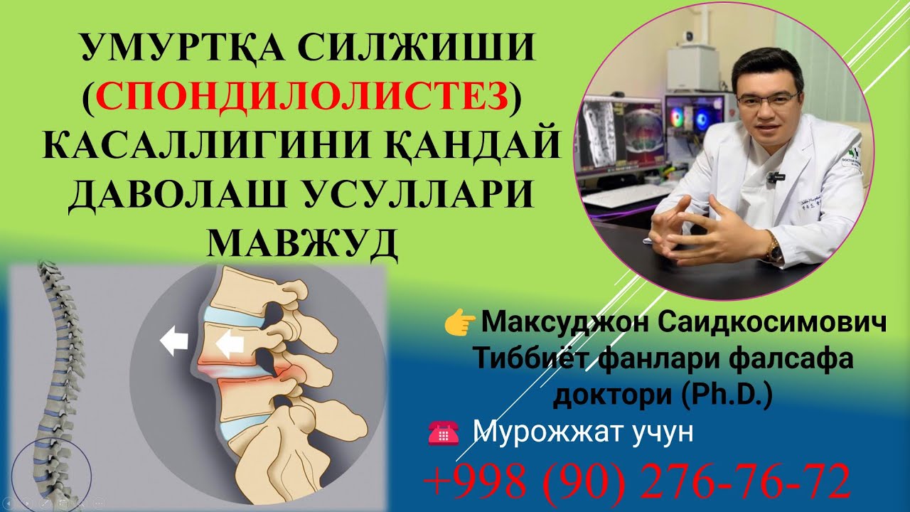ГРЫЖА ЁКИ УМУРТКА СИЛЖИШИ (СПОНДИЛОЛИСТЕЗ) КАСАЛЛИГИНИ КАНДАЙ ДАВОЛАШ УСУЛЛАРИ МАВЖУД.