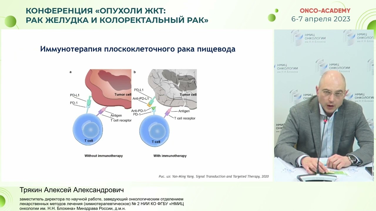 Возможности лекарственной терапии первой линии рака пищевода. Трякин А. А.