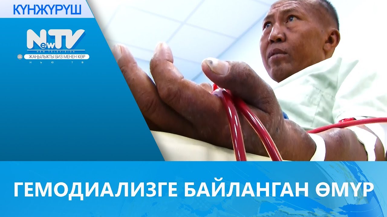 ГЕМОДИАЛИЗГЕ БАЙЛАНГАН ӨМҮР