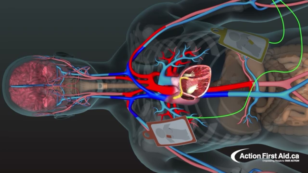 How and AED works