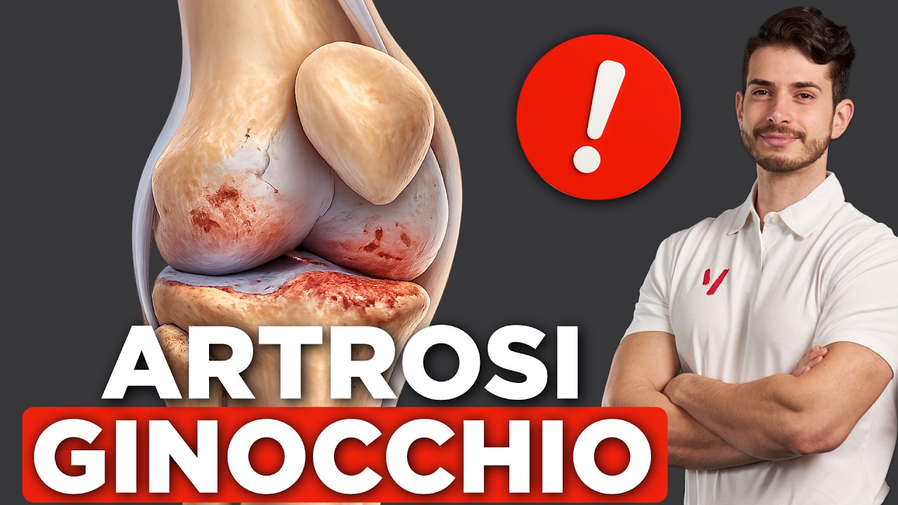 ARTROSI al GINOCCHIO: la GUIDA COMPLETA (ginocchio 