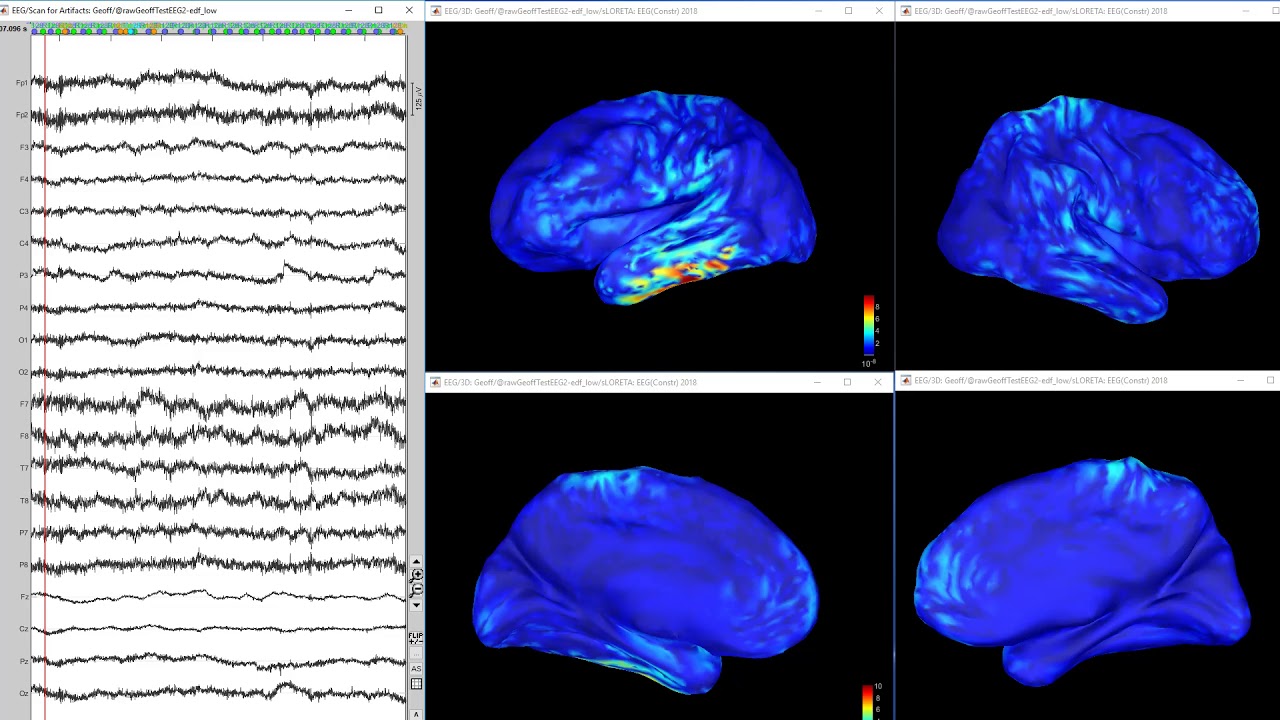 Subcortical structures