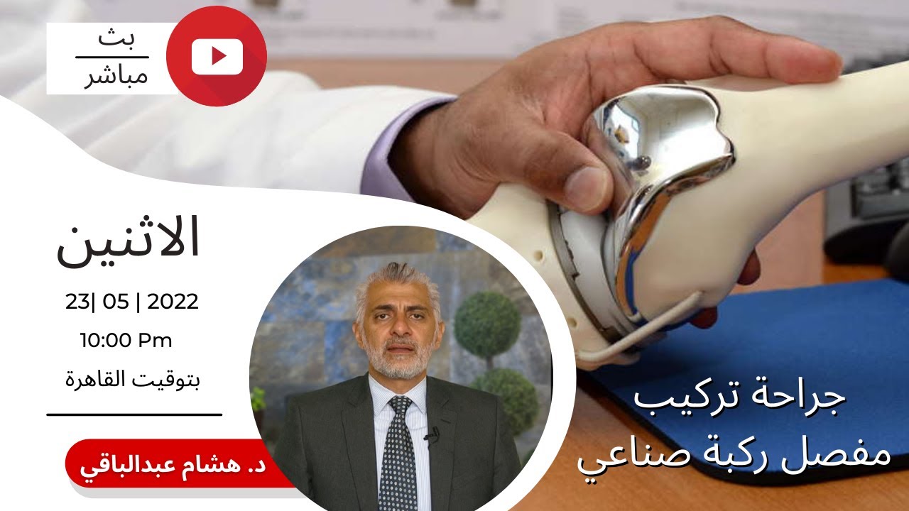 بث حي عن جراحة  مفصل الركبة الصناعي