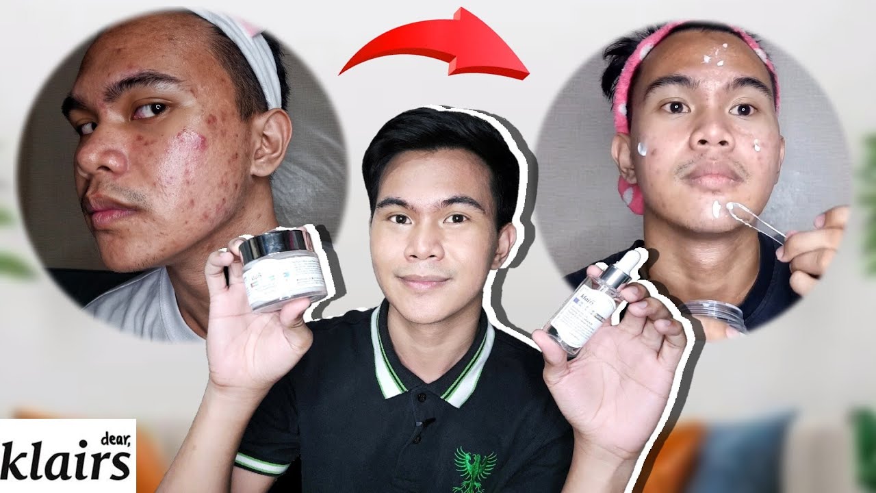 BEST SKINCARE COMBINATION FOR PIMPLE MARKS | KLAIRS VITAMIN C SERUM AND VITAMIN E MASK REVIEW
