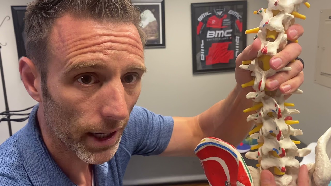 🏃🏼‍♂️Sacral 🏃🏼‍♂️(tailbone) stress fracture ?