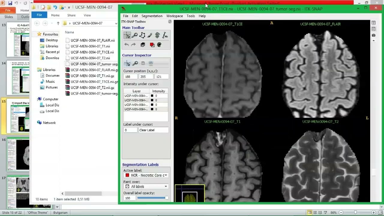 Itk-Snap Guide in the Context of Brain Tumor Segmentation