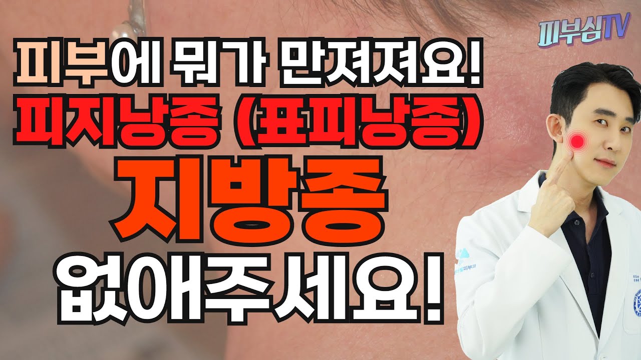 피부에 뭐가 만져져요! 피지낭종 지방종 없애주세요! [피부과전문의 피부심]