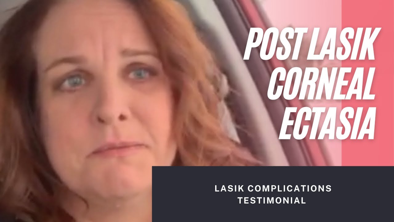 [USA] -  Post LASIK Corneal Ectasia Testimonial