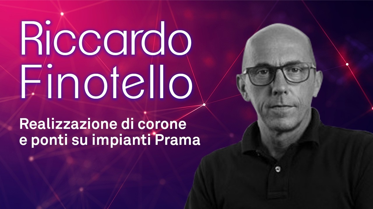 Realizzazione di corone e ponti su impianti Prama