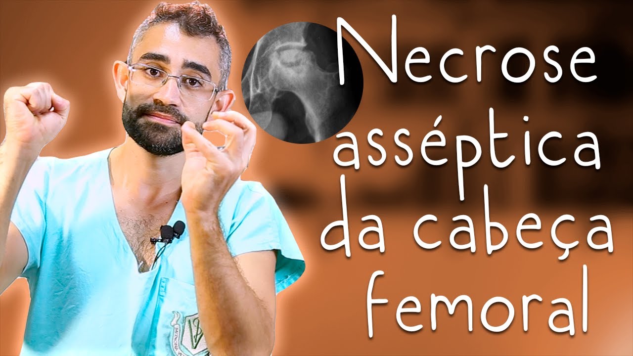 Necrose asséptica da cabeça do fêmur | Dica Veterinária #82