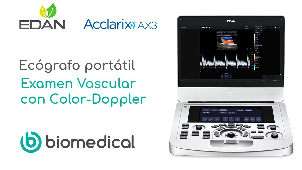 TUTORIAL: REALIZACIÓN DE EXAMEN VASCULAR CON COLOR DOPPLER | ECÓGRAFO PORTÁTIL ACCLARIX AX3 EDAN